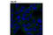Decapping MRNA 1B antibody, 13233S, Cell Signaling Technology, Immunocytochemistry image 
