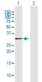 Bardet-Biedl Syndrome 9 antibody, H00027241-D02P, Novus Biologicals, Western Blot image 