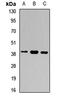 G Protein Subunit Beta 5 antibody, LS-C667824, Lifespan Biosciences, Western Blot image 