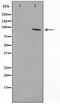 RB Associated KRAB Zinc Finger antibody, TA347588, Origene, Western Blot image 