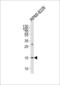 Regenerating Family Member 3 Alpha antibody, LS-C162533, Lifespan Biosciences, Western Blot image 