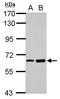 Spermatogenesis Associated 16 antibody, GTX109460, GeneTex, Western Blot image 