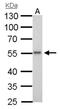 ETS Transcription Factor ERG antibody, NBP1-31370, Novus Biologicals, Western Blot image 