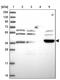 Armadillo Repeat Containing X-Linked 6 antibody, PA5-60206, Invitrogen Antibodies, Western Blot image 