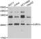 GTP-binding protein SAR1a antibody, LS-C349173, Lifespan Biosciences, Western Blot image 