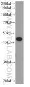 ST6 N-Acetylgalactosaminide Alpha-2,6-Sialyltransferase 6 antibody, 66209-1-Ig, Proteintech Group, Western Blot image 
