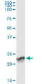 Guanylate Kinase 1 antibody, LS-C197386, Lifespan Biosciences, Immunoprecipitation image 