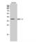 Zinc Finger DHHC-Type Containing 15 antibody, LS-C383127, Lifespan Biosciences, Western Blot image 