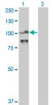 Actinin Alpha 4 antibody, LS-B5374, Lifespan Biosciences, Western Blot image 