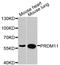 PR/SET Domain 11 antibody, STJ110800, St John