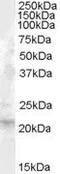 Fibroblast growth factor 21 antibody, PA5-18811, Invitrogen Antibodies, Western Blot image 