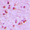 Forkhead Box R1 antibody, LS-C353668, Lifespan Biosciences, Immunohistochemistry paraffin image 