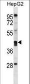 Paraoxonase 2 antibody, LS-B10154, Lifespan Biosciences, Western Blot image 