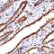 Cathepsin L antibody, PA5-47971, Invitrogen Antibodies, Immunohistochemistry frozen image 