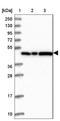 Ankyrin Repeat Domain 27 antibody, NBP1-85111, Novus Biologicals, Western Blot image 