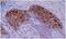 Keratin 10 antibody, GTX21421, GeneTex, Immunohistochemistry paraffin image 