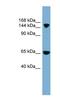 Solute Carrier Family 4 Member 5 antibody, NBP1-59528, Novus Biologicals, Western Blot image 
