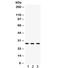 Dickkopf WNT Signaling Pathway Inhibitor 2 antibody, R32344, NSJ Bioreagents, Western Blot image 