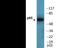 p65 antibody, EKC2470, Boster Biological Technology, Western Blot image 