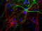 Neurofilament Heavy antibody, LS-C204552, Lifespan Biosciences, Immunocytochemistry image 