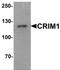 Cysteine Rich Transmembrane BMP Regulator 1 antibody, NBP2-81803, Novus Biologicals, Western Blot image 