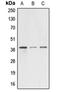 Alpha-1,4-N-Acetylglucosaminyltransferase antibody, LS-C353435, Lifespan Biosciences, Western Blot image 