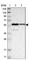 TRAP antibody, HPA009972, Atlas Antibodies, Western Blot image 