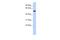 Zinc Finger Protein 572 antibody, A14315, Boster Biological Technology, Western Blot image 