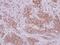 PRELI Domain Containing 1 antibody, LS-C155523, Lifespan Biosciences, Immunohistochemistry paraffin image 