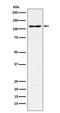 Selectin P Ligand antibody, M03674-1, Boster Biological Technology, Western Blot image 