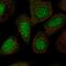 Thyroid Hormone Receptor Interactor 13 antibody, HPA005727, Atlas Antibodies, Immunofluorescence image 