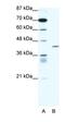 Peroxisome Proliferator Activated Receptor Delta antibody, orb329697, Biorbyt, Western Blot image 