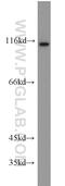 Forkhead Box M1 antibody, 13147-1-AP, Proteintech Group, Western Blot image 