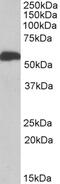 Cytochrome P450 Family 2 Subfamily E Member 1 antibody, 42-658, ProSci, Enzyme Linked Immunosorbent Assay image 