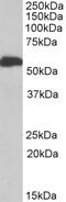 Cytochrome P450 Family 2 Subfamily E Member 1 antibody, 42-658, ProSci, Enzyme Linked Immunosorbent Assay image 