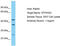 GTF2H2 Family Member C, Copy 2 antibody, TA330874, Origene, Western Blot image 