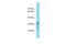 Chromosome 8 Open Reading Frame 74 antibody, A14035, Boster Biological Technology, Western Blot image 