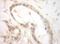 Eukaryotic Translation Initiation Factor 2B Subunit Epsilon antibody, NBP1-30448, Novus Biologicals, Immunohistochemistry paraffin image 