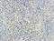 Peroxisome Proliferator Activated Receptor Gamma antibody, orb389323, Biorbyt, Immunohistochemistry paraffin image 