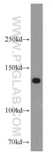 BUB1 Mitotic Checkpoint Serine/Threonine Kinase B antibody, 11504-2-AP, Proteintech Group, Western Blot image 