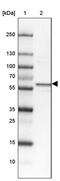 Syntaxin Binding Protein 4 antibody, PA5-55020, Invitrogen Antibodies, Western Blot image 