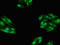 TBC1 Domain Family Member 15 antibody, LS-C672313, Lifespan Biosciences, Immunofluorescence image 