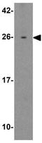 Spermatogenesis Associated 3 antibody, GTX32039, GeneTex, Western Blot image 