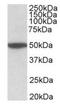 Cholinergic Receptor Muscarinic 2 antibody, orb12313, Biorbyt, Western Blot image 