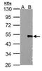 Wnt Family Member 5A antibody, GTX100618, GeneTex, Western Blot image 