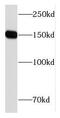 Carbamoyl-Phosphate Synthase 1 antibody, FNab01934, FineTest, Western Blot image 