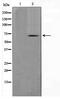 CHN antibody, TA347578, Origene, Western Blot image 