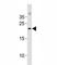 O-6-Methylguanine-DNA Methyltransferase antibody, F42543-0.4ML, NSJ Bioreagents, Flow Cytometry image 