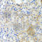 Peroxisomal Biogenesis Factor 3 antibody, A7352, ABclonal Technology, Immunohistochemistry paraffin image 