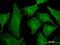 Tropomodulin 3 antibody, H00029766-M10, Novus Biologicals, Immunofluorescence image 